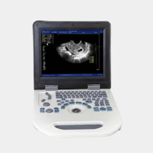 Mindray Nyro 10 Portable Ultrasound Machine
